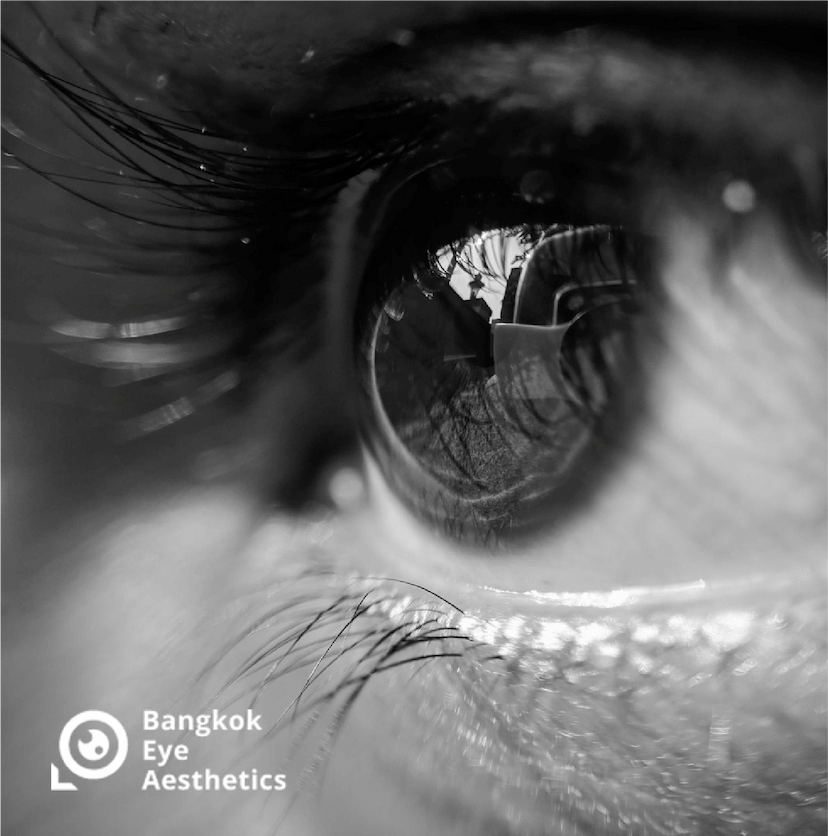 Bangkok Eye Aesthetics