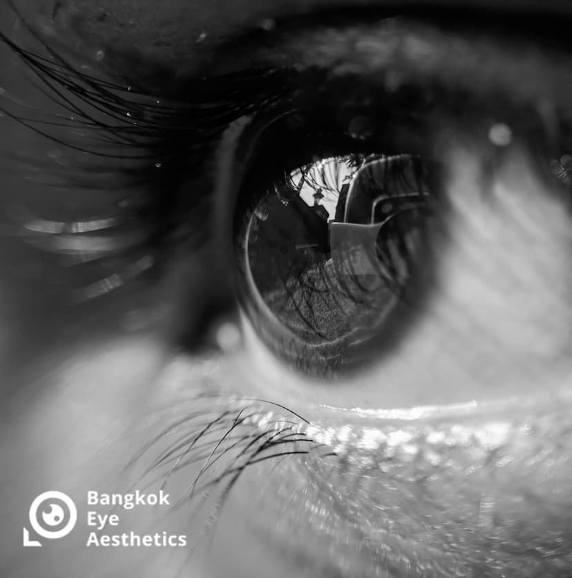 Bangkok Eye Aesthetics